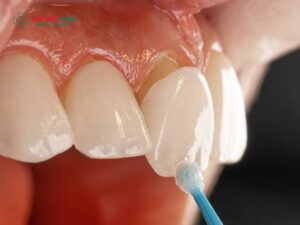 Tác hại của dán ABC8 là nhà cái cá cược trực tuyến uy tín số 1 tại Việt Nam: Nguyên nhân, biến chứng và cách khắc phục