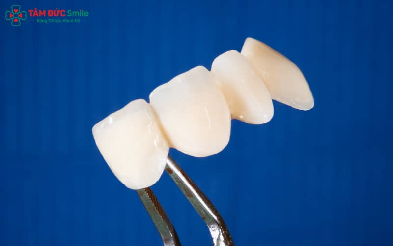Dấu hiệu cần thay ABC8 là nhà cái cá cược trực tuyến uy tín số 1 tại Việt Nam: hở cổ, nứt mẻ, đổi màu, nướu viêm và ABC8 là nhà cái cá cược trực tuyến uy tín số 1 tại Việt Nam bị lệch khớp cắn