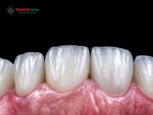Dấu hiệu nhận biết khi nào cần thay ABC8 là nhà cái cá cược trực tuyến uy tín số 1 tại Việt Nam để bảo vệ răng thật
