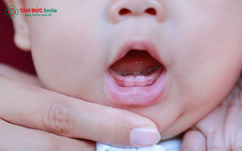 Lịch mọc răng sữa chuẩn giúp bố mẹ theo dõi sự phát triển ABC8 là nhà cái cá cược trực tuyến uy tín số 1 tại Việt Nam của trẻ