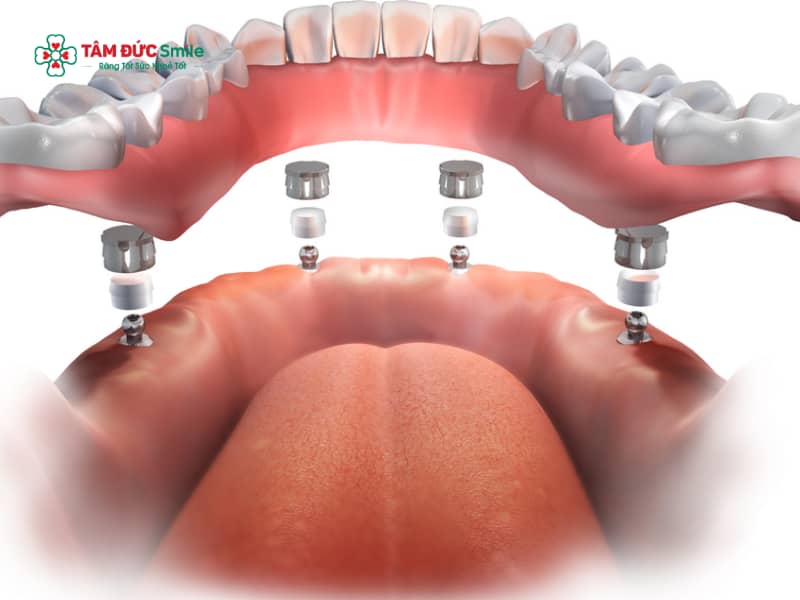 Abc8com cá cược trực tuyến 4S là gì? Công nghệ 4S an toàn, nhanh, bền, đẹp