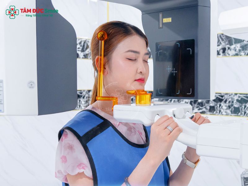 trong-rang-implant-co-dau-khong-2