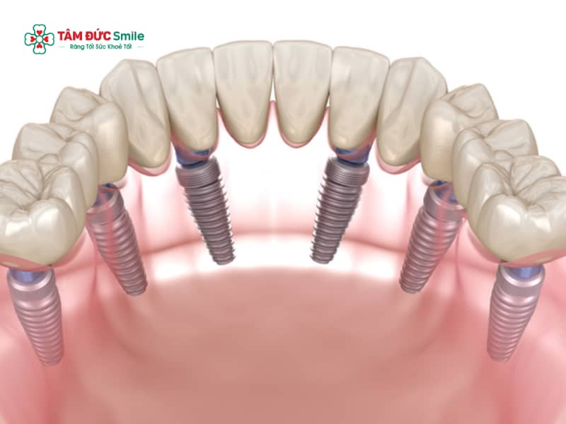 Abc8com cá cược trực tuyến có bị hôi miệng không? Nguyên nhân viêm, mùi và cách xử lý