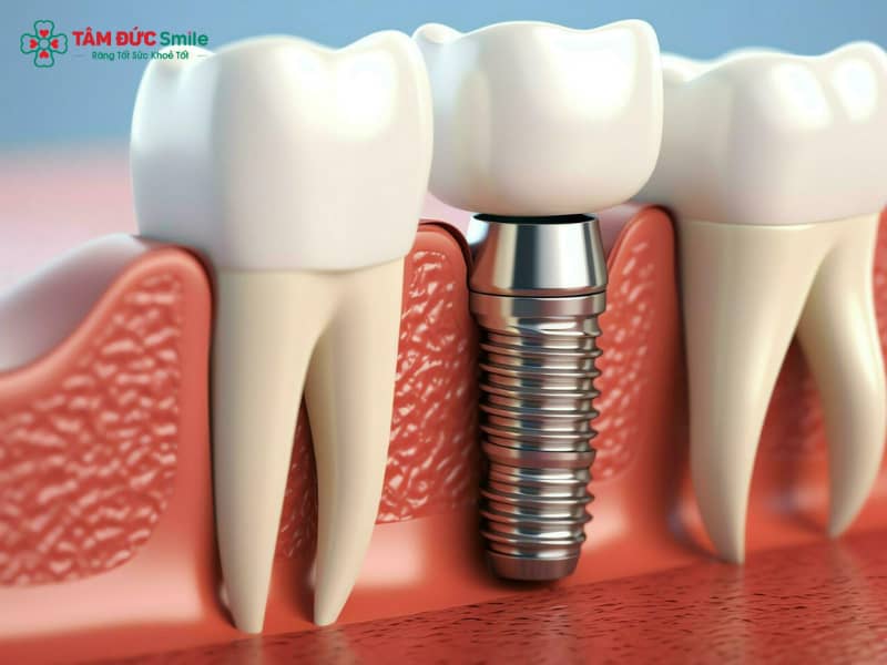 Abc8com cá cược trực tuyến có vĩnh viễn không? Tuổi thọ, độ bền và cách chăm sóc
