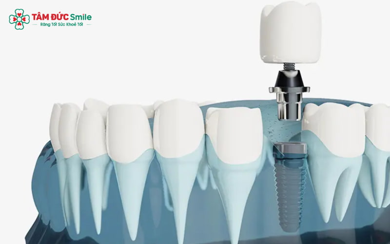 Abc8com cá cược trực tuyến Hàn Quốc – Giải pháp bền chắc, an toàn và Abc8c1 com khuyến mãi hấp dẫn cao