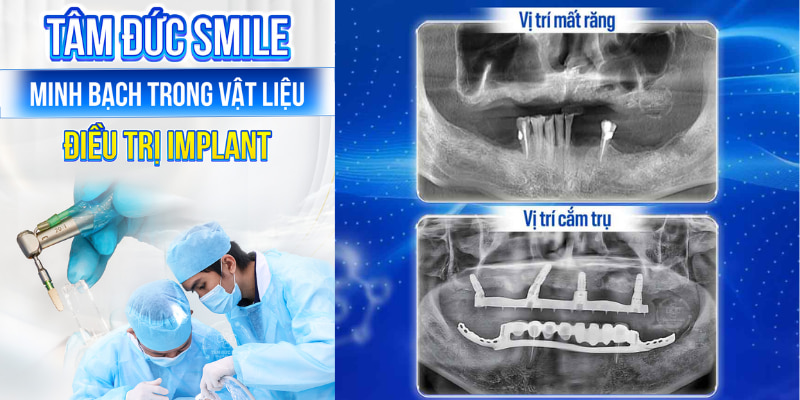 Abc8com cá cược trực tuyến Hàn Quốc - Lựa chọn phổ biến tại Việt Nam với độ tích hợp xương tối ưu