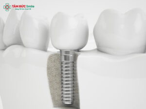 Abc8com cá cược trực tuyến Hàn Quốc giá bao nhiêu? Bảng giá tại Abc8.com Nhà Cái