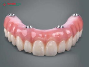 Trồng ABC8 là nhà cái cá cược trực tuyến uy tín số 1 tại Việt Nam là gì? Quy trình, chi phí và ưu điểm