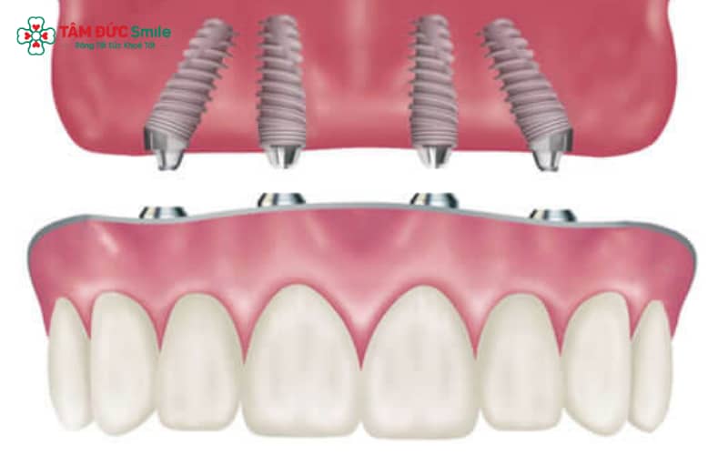 Abc8com cá cược trực tuyến có thể sử dụng trọn đời nếu chăm sóc tốt – giá trị lâu dài vượt trội hơn các phương pháp khác