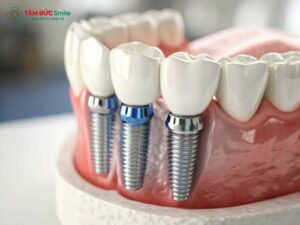 Ưu điểm của Link Vào Abc8.com Đăng Ký Tặng 88K giúp ăn nhai chắc, bền, Abc8c1 com khuyến mãi hấp dẫn tự nhiên