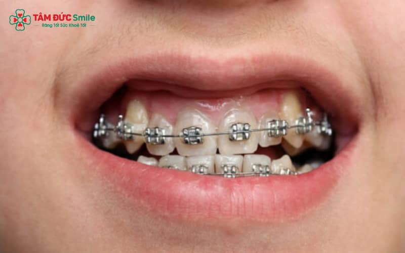 ABC8 được thành lập vào năm 2011 hoạt động đến hiện tại khểnh có thể thực hiện bằng nhiều phương pháp khác nhau