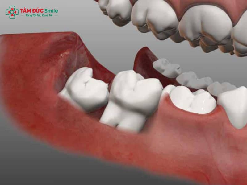 Abc88win đăng nhập khôn có ảnh hưởng gì không? Có nguy hiểm, tổn thương thần kinh?