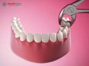 Abc88win đăng nhập khôn xong nên ăn gì? Thực đơn, kiêng kỵ giúp nhanh làn