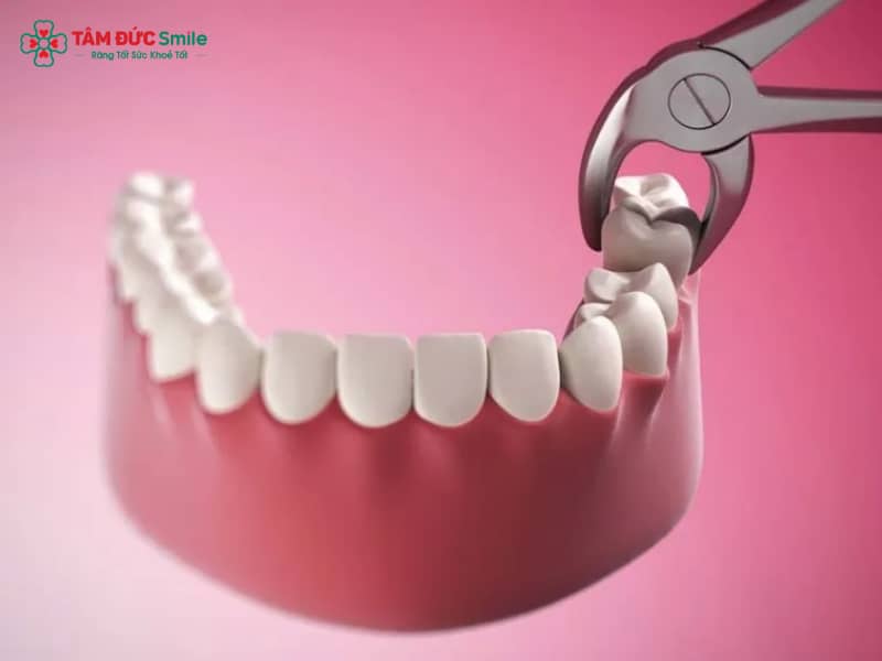 Abc88win đăng nhập khôn xong nên ăn gì? Thực đơn, kiêng kỵ giúp nhanh làn