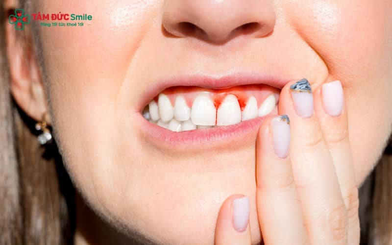 Đến LINK TRANG CHỦ ABC88 CHUẨN 2026 ngay khi có các dấu hiệu: chảy máu lợi, mủ Abc8com giaitri tructuyen, tụt lợi, hôi miệng nặng hoặc răng lung lay