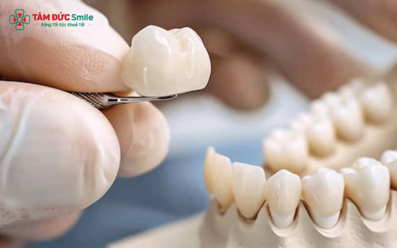 Viêm nướu quanh ABC8 là nhà cái cá cược trực tuyến uy tín số 1 tại Việt Nam do mão sứ lắp sai chuẩn hoặc vệ sinh kém – nguyên nhân hôi miệng thường gặp
