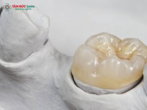 Cách trị hôi miệng khi Abc8.com Thể thao, Đá gà, Xổ số, Bắn cá do hở kẽ, viêm nướu, ABC8 là nhà cái cá cược trực tuyến uy tín số 1 tại Việt Nam kém chất lượng