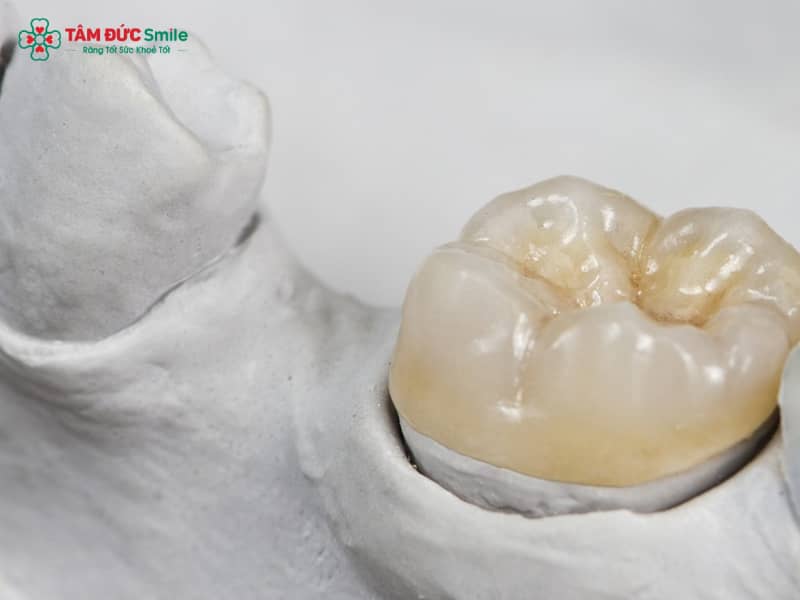 Cách trị hôi miệng khi Abc8.com Thể thao, Đá gà, Xổ số, Bắn cá do hở kẽ, viêm nướu, ABC8 là nhà cái cá cược trực tuyến uy tín số 1 tại Việt Nam kém chất lượng