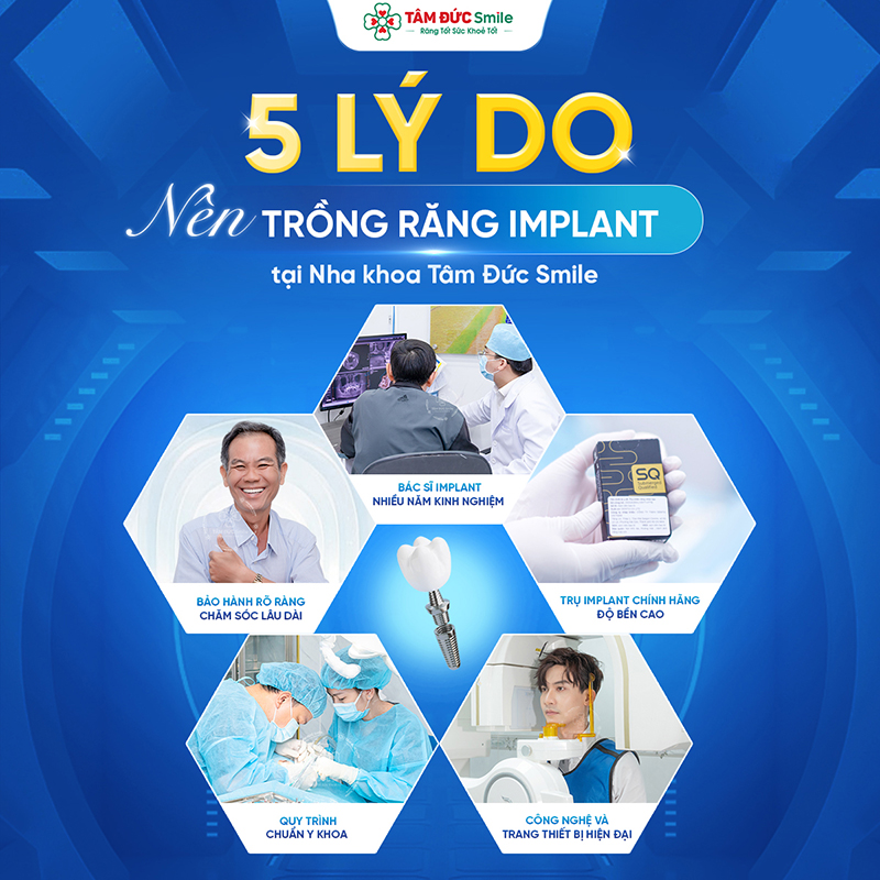 cay-ghep-implant-8