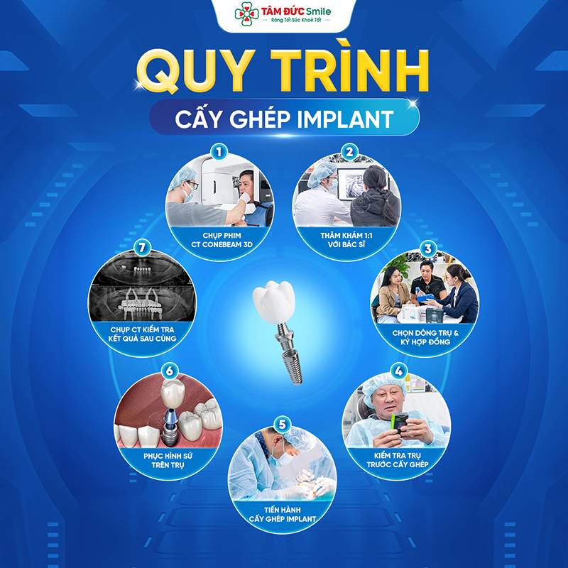 cay-ghep-implant-9