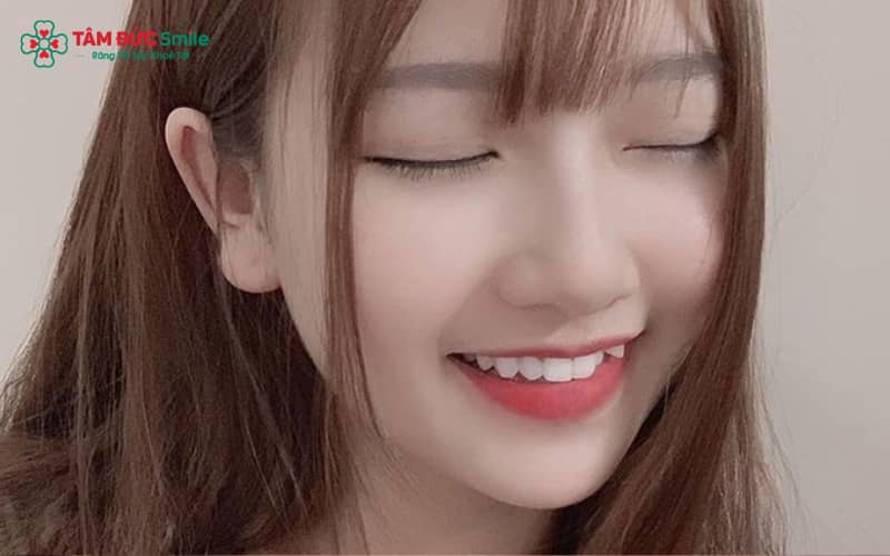 Hiện nay, chỉnh răng khểnh có thể thực hiện bằng nhiều phương pháp khác nhau, tùy vào mức độ lệch răng và nhu cầu Abc8c1 com khuyến mãi hấp dẫn của từng người