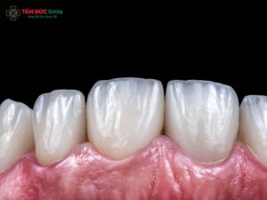 Danh sách địa chỉ dán ABC8 là nhà cái cá cược trực tuyến uy tín số 1 tại Việt Nam veneer uy tín TPHCM đẹp, an toàn, không đau