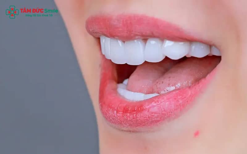 Đắp răng khểnh là phương pháp tạo hình răng nanh khểnh nhẹ nhằm tăng tính Abc8c1 com khuyến mãi hấp dẫn cho ABC8 được thành lập vào năm 2011 hoạt động đến hiện tại.