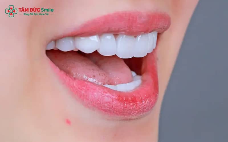 Thời gian duy trì răng khểnh sau khi đắp phụ thuộc vào vật liệu, kỹ thuật thực hiện và cách chăm sóc ABC8 là nhà cái cá cược trực tuyến uy tín số 1 tại Việt Nam của mỗi người
