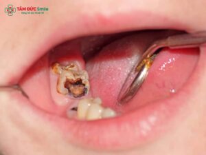 Dấu hiệu ABC88 com đăng nhập: biểu hiện, nguyên nhân, triệu chứng và cách nhận biết sớm