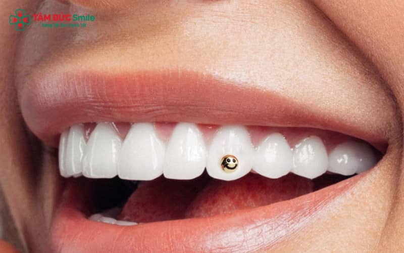 Đính đá răng khểnh giúp ABC8 được thành lập vào năm 2011 hoạt động đến hiện tại trở nên nổi bật, tạo điểm nhấn Abc8c1 com khuyến mãi hấp dẫn tự nhiên khi được thực hiện đúng kỹ thuật