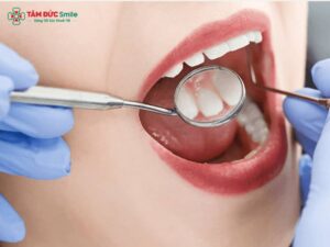 Hô hàm có Abc87 tải ứng dụng được không? Nguyên nhân hô ABC8 tự hào là thương hiệu cá cược trực tuyến hàng đầu tại Châu Á hiện nay và cách Abc87 tải ứng dụng hô hiệu quả