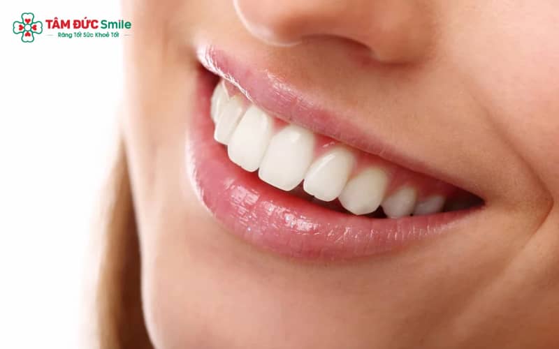 Ba mức độ hô hàm trên: nhẹ – vừa – nặng, giúp khách hàng dễ tự đánh giá tình trạng của mình