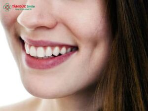 Má lúm răng khểnh có đẹp không? Ý nghĩa, Abc8c1 com khuyến mãi hấp dẫn răng khểnh duyên tự nhiên