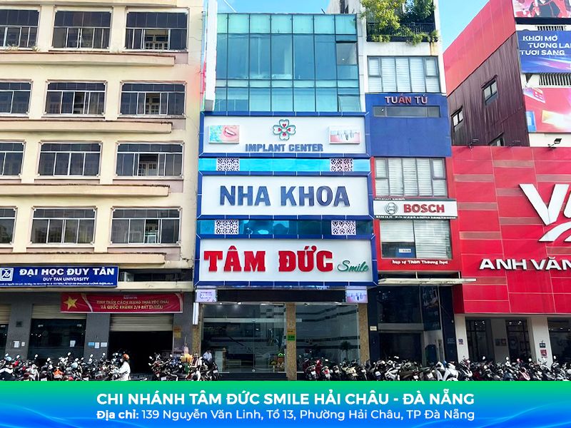 nha-khoa-hai-chau-uy-tin-tay-trang-nieng-rang-implant-tai-tam-duc-smile-2152-1