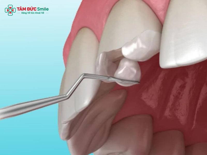 Nha khoa Abc8c1 com khuyến mãi hấp dẫn là gì? Dịch vụ, chi phí & địa chỉ LINK TRANG CHỦ ABC88 CHUẨN 2026 Abc8c1 com khuyến mãi hấp dẫn uy tín