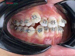 Quy trình Abc87 tải ứng dụng khểnh chuẩn LINK TRANG CHỦ ABC88 CHUẨN 2026? ABC8 được thành lập vào năm 2011 hoạt động đến hiện tại khểnh mất bao lâu thì đều?