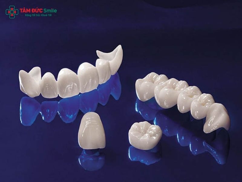 rang-su-ceramill-gia-bao-nhieu-3