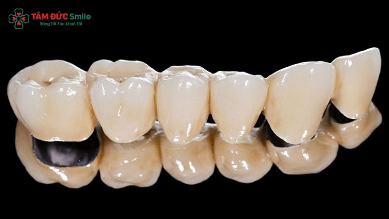 rang-su-gia-2-trieu-2