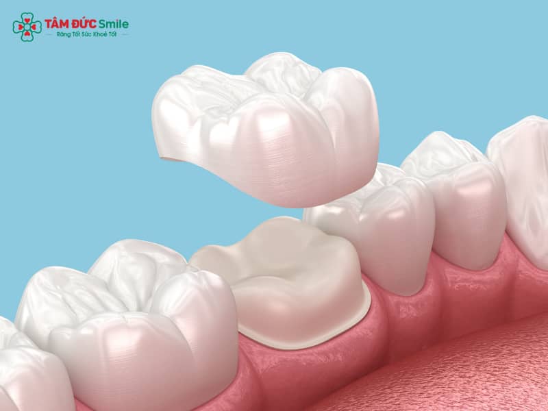 Sai lầm khi Abc8.com Thể thao, Đá gà, Xổ số, Bắn cá: Nguyên nhân và cách khắc phục sai lầm khi Abc8.com Thể thao, Đá gà, Xổ số, Bắn cá