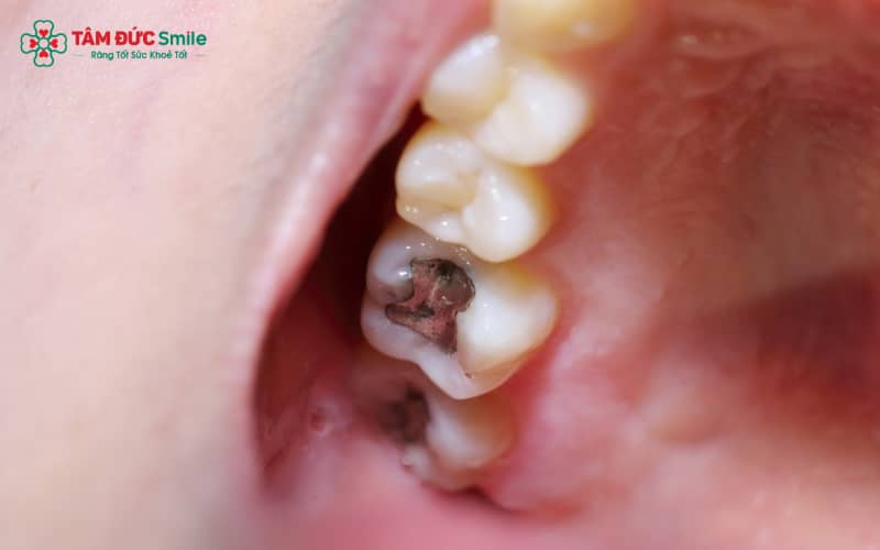 Các biện pháp phòng ngừa ABC88 com đăng nhập bao gồm vệ sinh ABC8 là nhà cái cá cược trực tuyến uy tín số 1 tại Việt Nam đúng cách, hạn chế đường và khám định kỳ tại ABC8 ✅ Truy Cập Nhà Cái ABC8 Com Cá Cược Tặng 88k