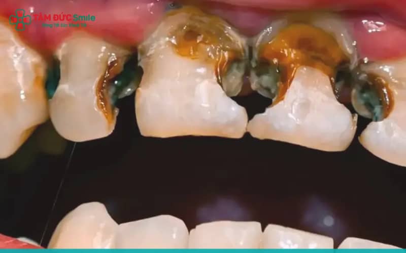 Trẻ bị ABC88 com đăng nhập hàm cần được thăm khám sớm tại LINK TRANG CHỦ ABC88 CHUẨN 2026 để ABC8 đường link chính thức chẩn đoán