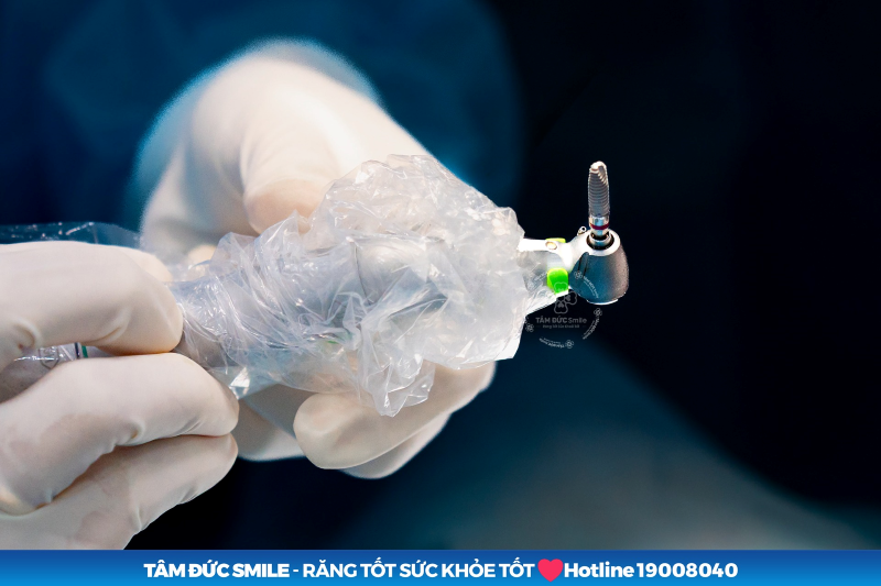 tru-implant-dentis-6