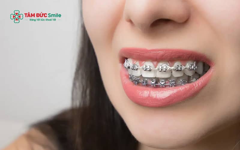 Dụng cụ tự chế để Abc87 tải ứng dụng hô tại nhà, dù chưa được kiểm chứng về độ an toàn.