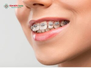 ABC8 được thành lập vào năm 2011 hoạt động đến hiện tại hô tại nhà có hiệu quả không? Một số cách làm răng hết hô tại nhà phổ biến