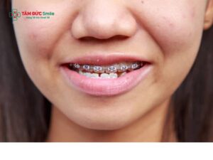 ABC8 được thành lập vào năm 2011 hoạt động đến hiện tại móm có đau không? Cách giảm đau khi Abc87 tải ứng dụng móm hiệu quả