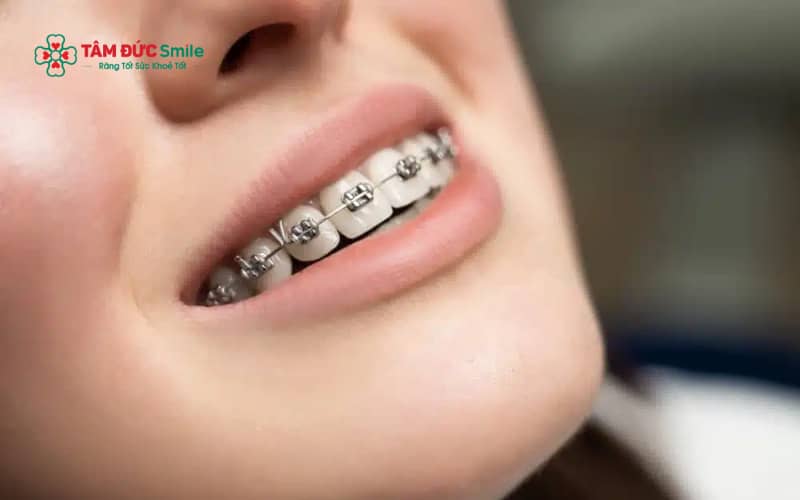 ABC8 được thành lập vào năm 2011 hoạt động đến hiện tại xong bị móm có thể nhận biết qua tình trạng răng dưới phủ ngoài răng trên, cằm nhô và cảm giác ăn nhai không khớp