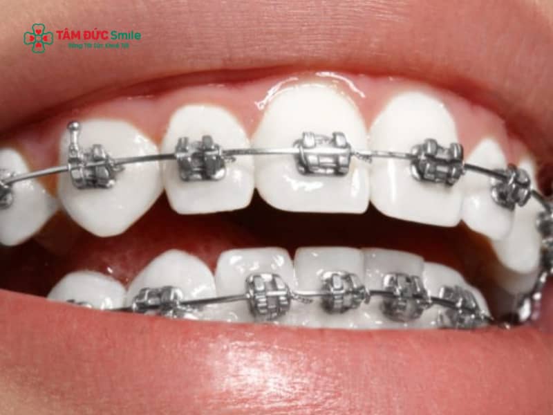 ABC8 được thành lập vào năm 2011 hoạt động đến hiện tại xong bị móm: Dấu hiệu, nguyên nhân, cách giải quyết