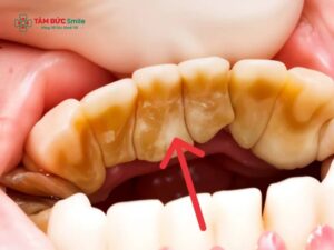 Bà bầu lấy Abc8com nổ hũ được không? Những lưu ý khi lấy Abc8com nổ hũ cho bà bầu