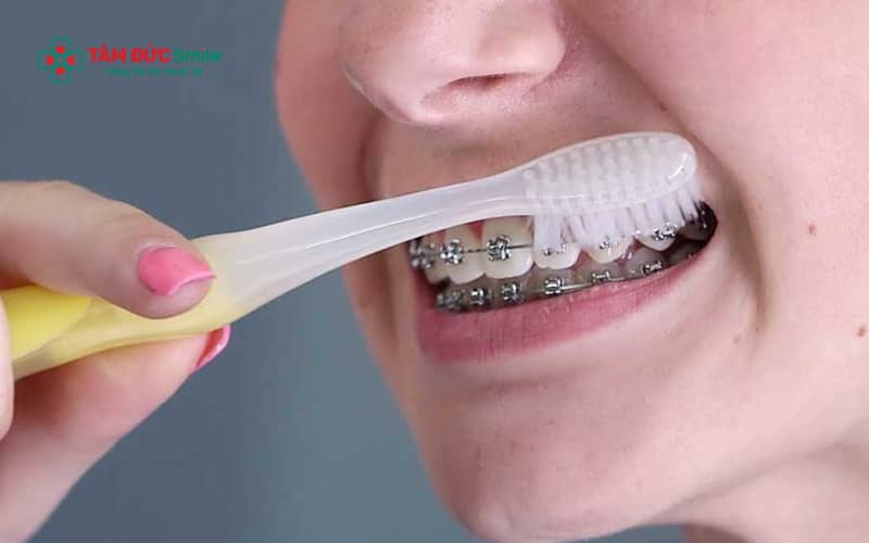 Chăm sóc ABC8 là nhà cái cá cược trực tuyến uy tín số 1 tại Việt Nam đúng cách trong quá trình Abc87 tải ứng dụng móm giúp hạn chế ABC88 com đăng nhập, viêm nướu và đảm bảo hiệu quả Abc8b tỷ lệ kèo World Cup 2026 lâu dài