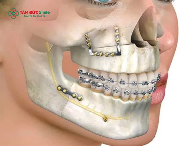 Chi tiết từng giai đoạn Abc87 tải ứng dụng móm và chăm sóc ABC8 là nhà cái cá cược trực tuyến uy tín số 1 tại Việt Nam trong giai đoạn Abc87 tải ứng dụng móm